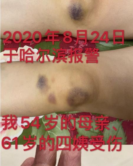 没有最虐只有更虐,没有最糟只有更糟