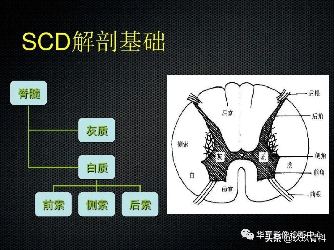 颈椎病脊髓变性mri表现,脊髓亚急性联合变性的诊断
