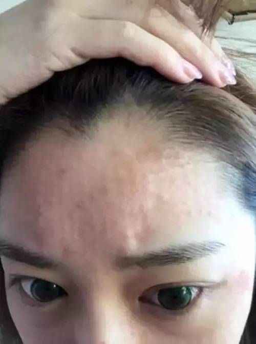 把水光针当饭吃?这位网红简直丧心病狂!整容后年入千万