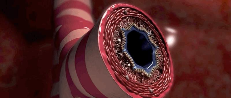 哮喘过敏症的症状,呼吸道过敏哮喘症状