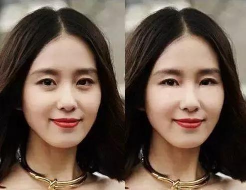 有一种整容叫美颜,有一种整容叫长大