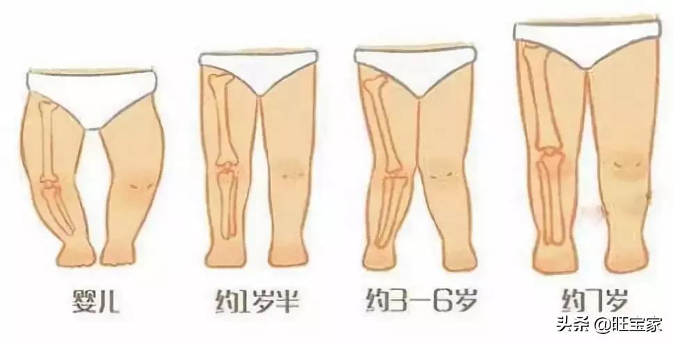 林允儿脸型,林允儿的o型腿