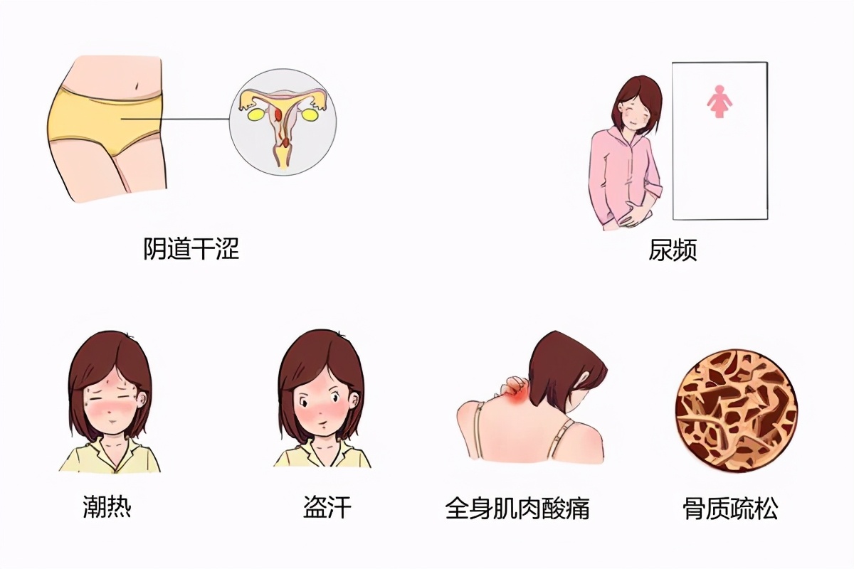 “更年期”是病吗？还是衰老的标志？听听妇科专家怎么说