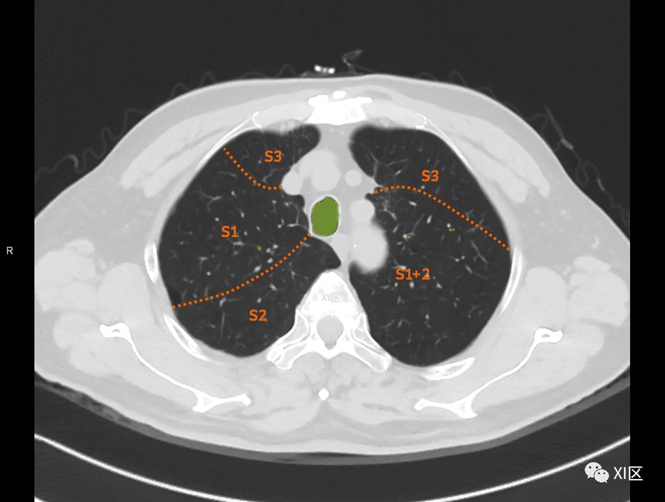 如此详细的肺部影像解剖，有点儿酷！