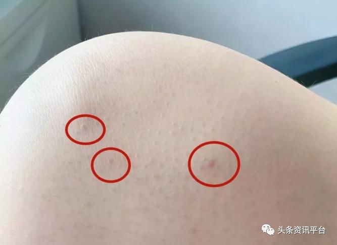 千谷生物科技,千谷高端溶脂线真的能瘦吗