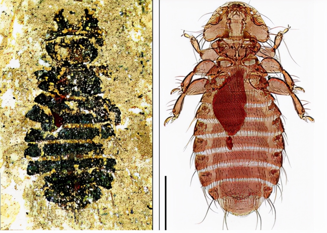 30年前的虱子现在怎么消失了,30年前人为什么都有虱子