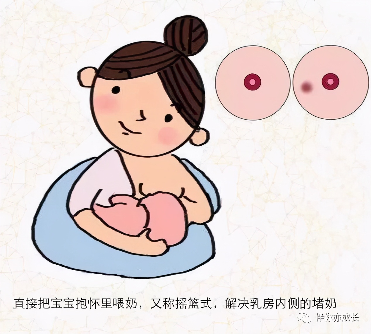 堵奶有硬块疼痛处理办法,堵奶如何处理