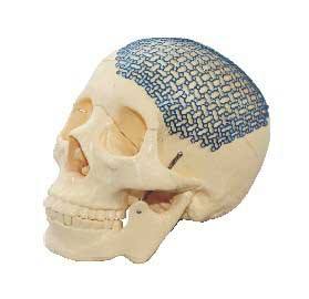 张医生大白话：一文读懂脑膜瘤