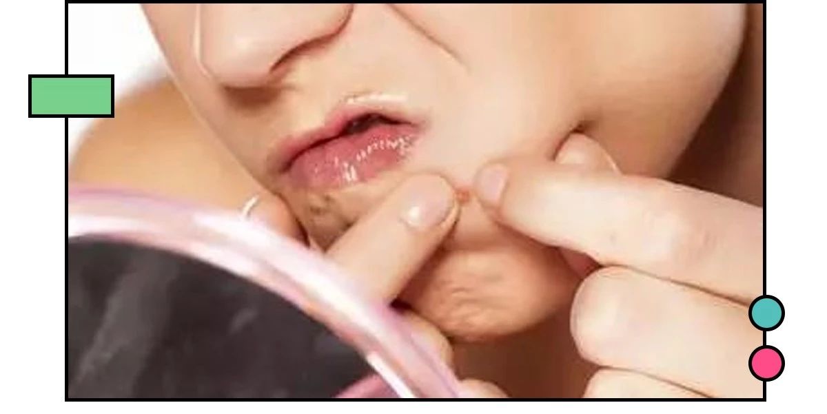 如何祛痘印？看了这篇能解决你大部分的问题！