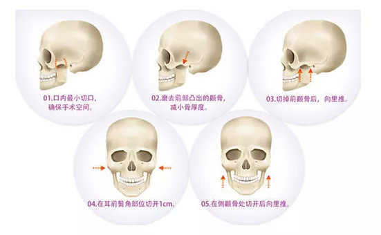整容也就图一乐,真投胎还得买神水