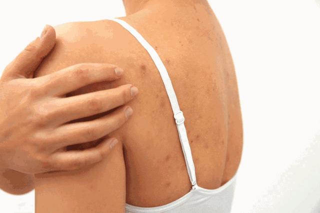 去角质的搓澡巾,加厚去角质搓澡巾