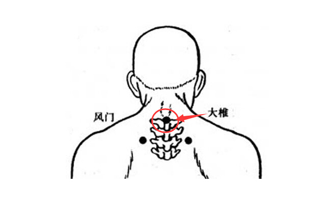 中医穴位调理治疗脂肪肝,中度脂肪肝养肝护肝穴位