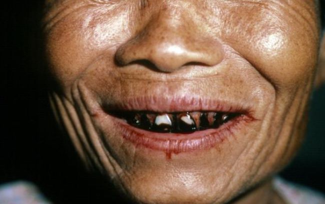 槟榔价格一路飙升原因,槟榔现在怎么价格降了那么多