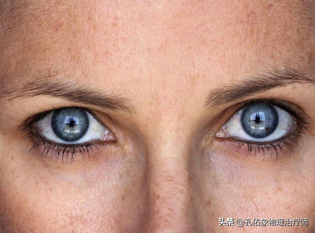 人身上的老年斑怎么去除,年轻人长老年斑消除最好的方法