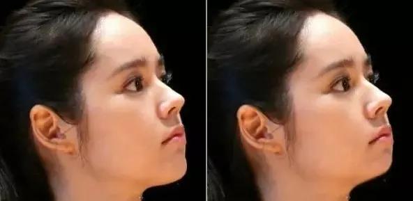 下巴短影响颜值,下巴对人的颜值的影响