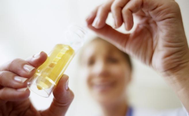 肾炎的种类到底有哪些,肾炎都有哪几种类型