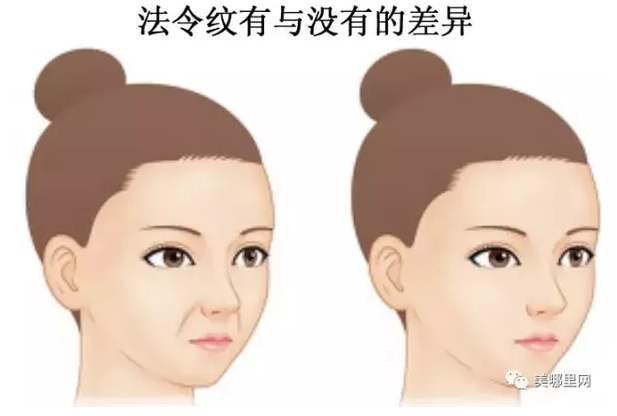 怎样改善法令纹深脸部下垂,怎样改善法令纹木偶纹