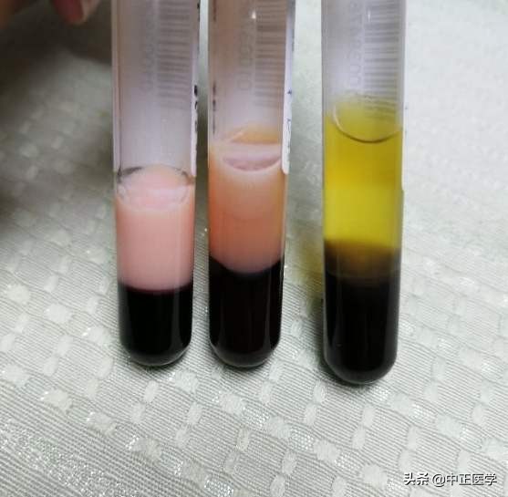 体检前吃个苹果会影响结果吗,体检前吃东西了怎么办