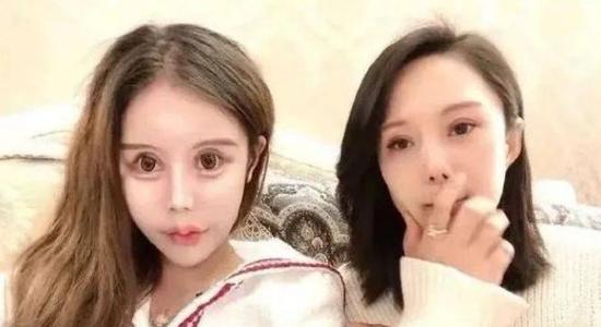 19岁少女因自己长得丑要去整容,13岁女孩变丑