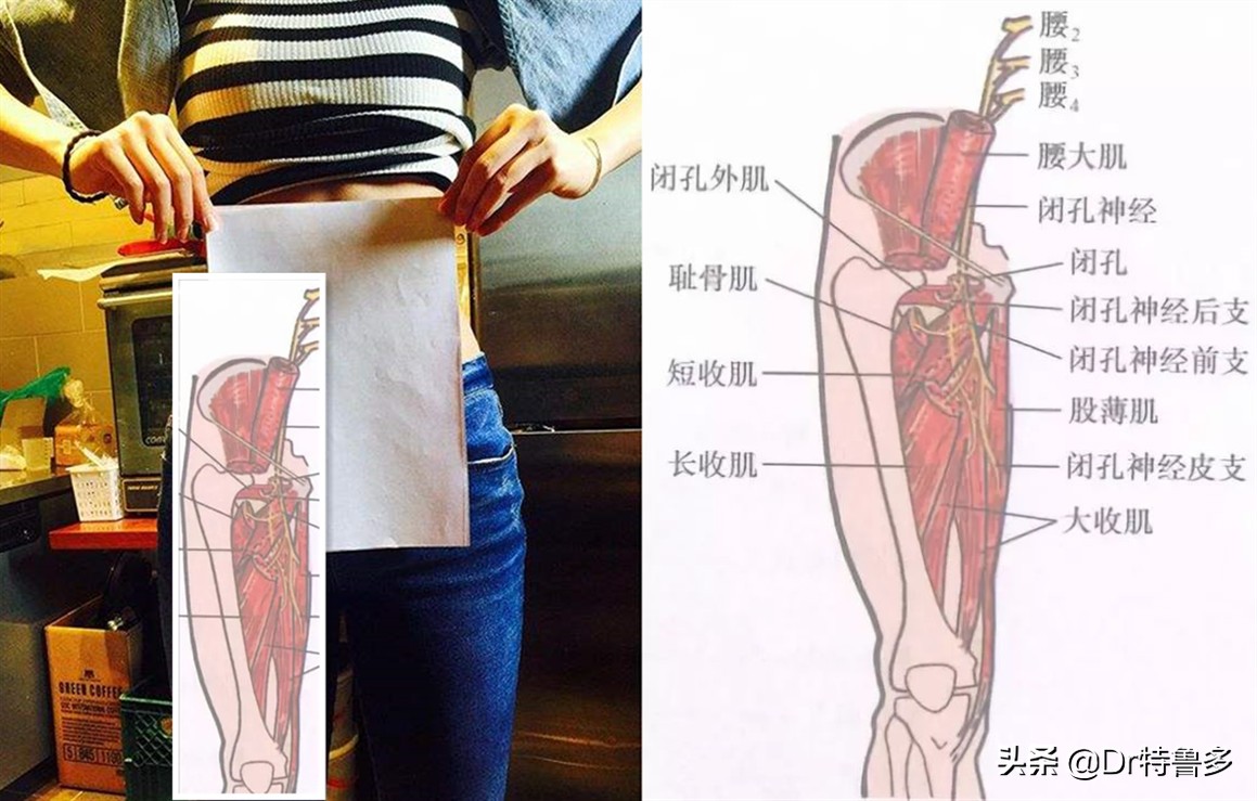大腿内侧痛，胯也痛...有根神经被卡住了