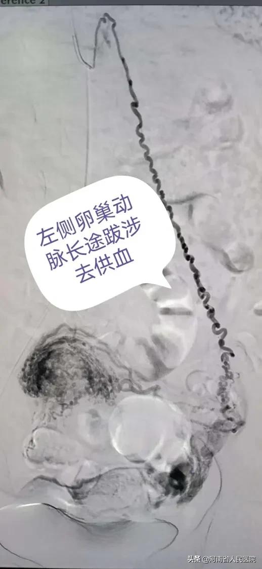 爬雪山过草地跨学科,爬雪山过草地历经二万五千里