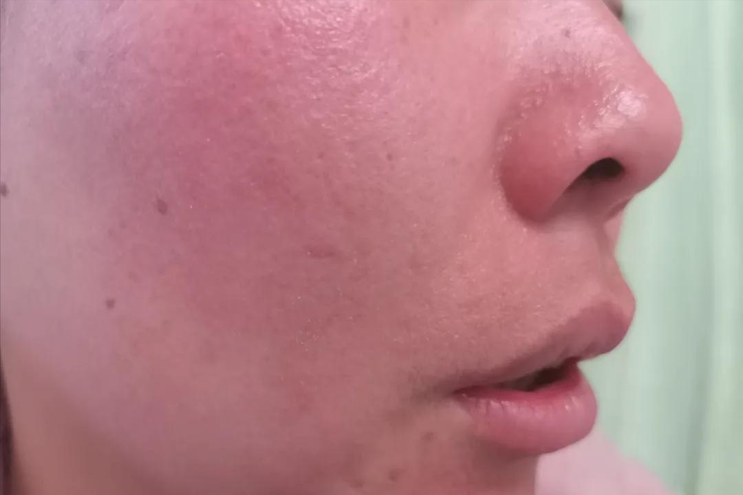 让你悄悄变美的4个小细节,让你偷偷变美的三种药膏