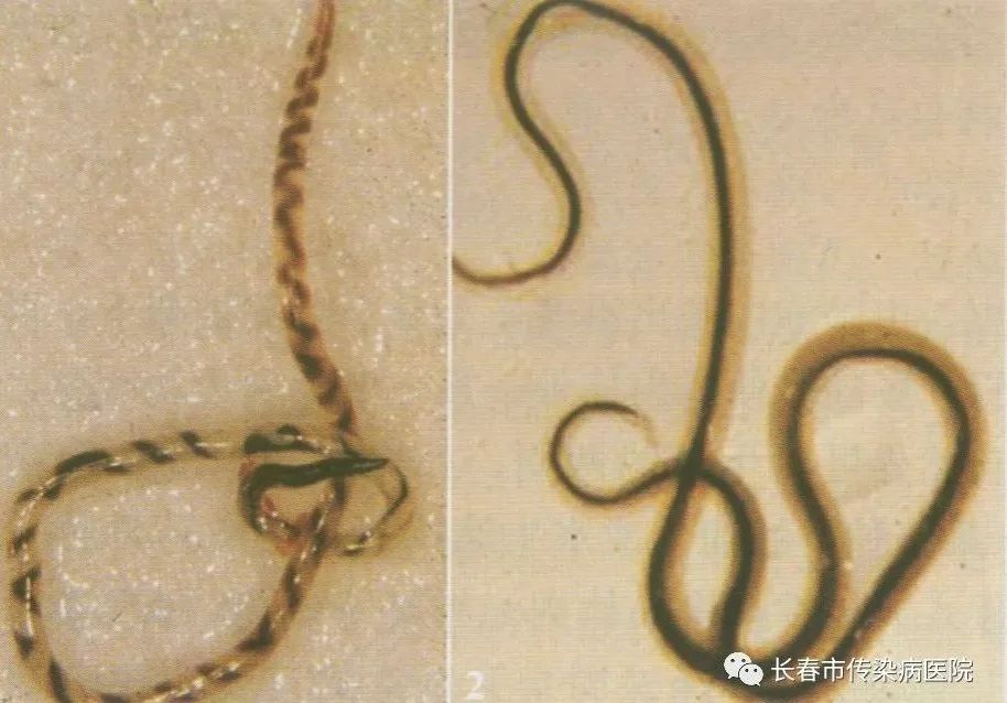 杨忠明医生说说广州管圆线虫病那些事
