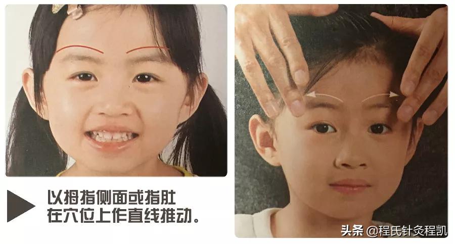 儿童感冒吃什么药不发热,儿童感冒初期用什么偏方比较好