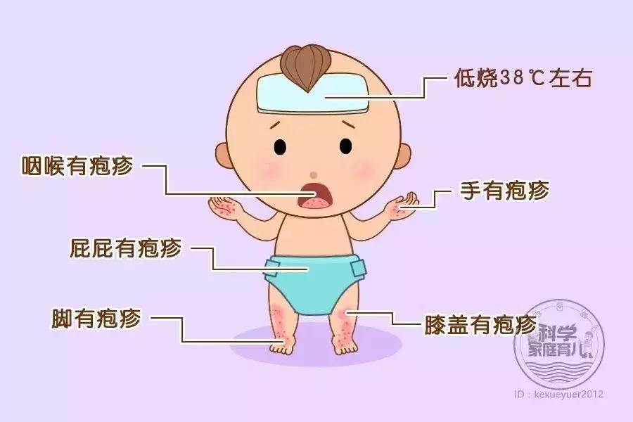 看图说病！专家提醒：立春后娃最易感染6种疹子，一定要认准了治