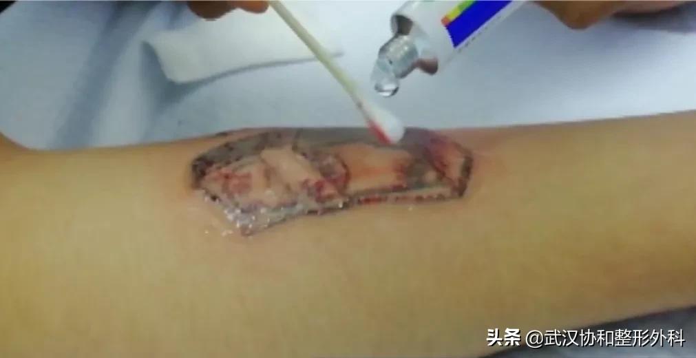 洗纹身最好的方法,洗纹身第一次效果