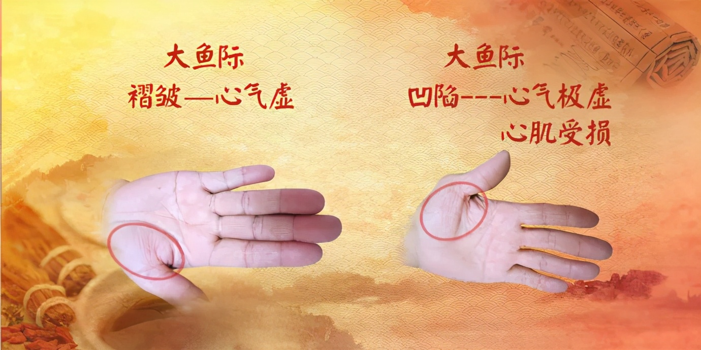 身体好不好,看手就知道!这几处变化可能藏大病