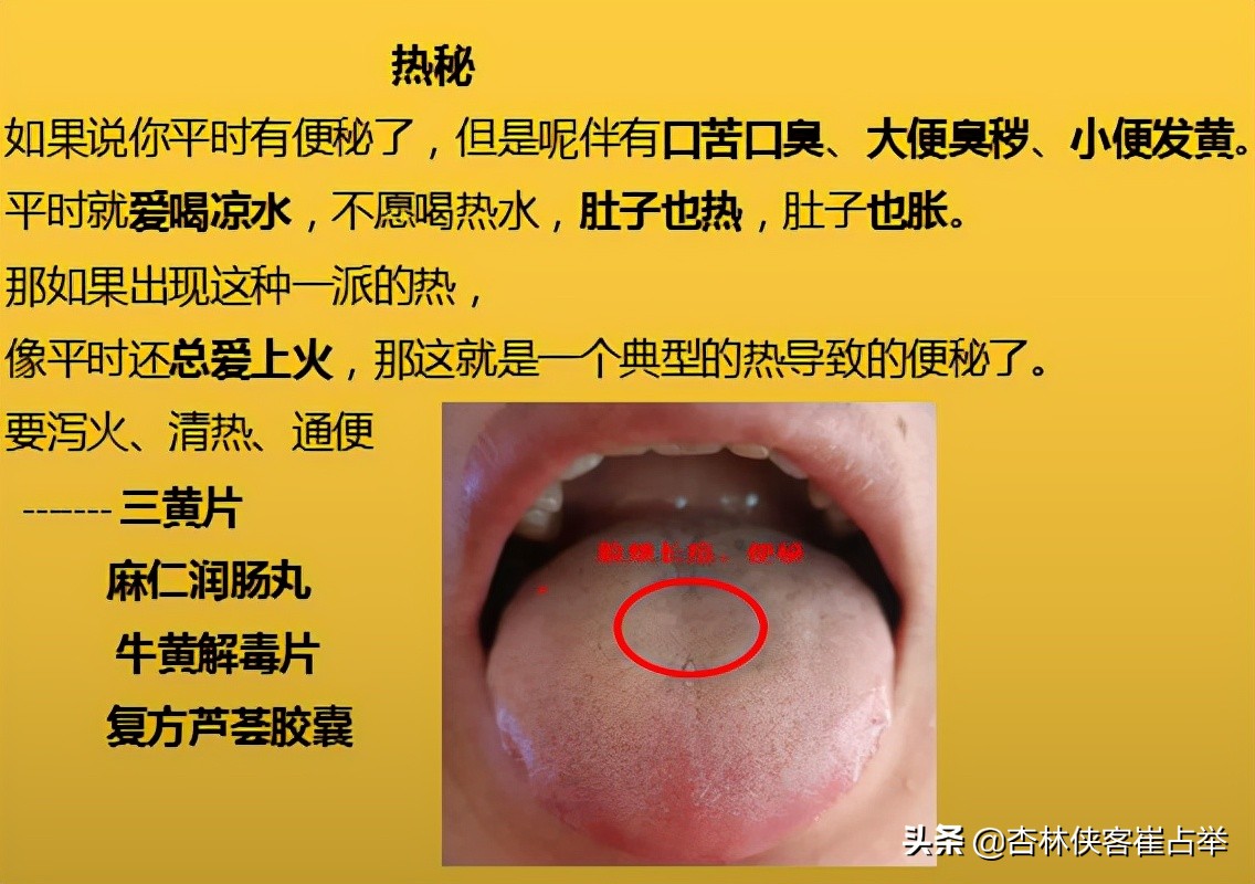 中医怎么治疗肠蠕动慢引起的便秘,糖尿病人长期便秘的中医解决方法
