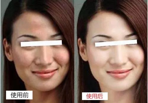 淡斑美白cp霜,美白淡斑cp推荐