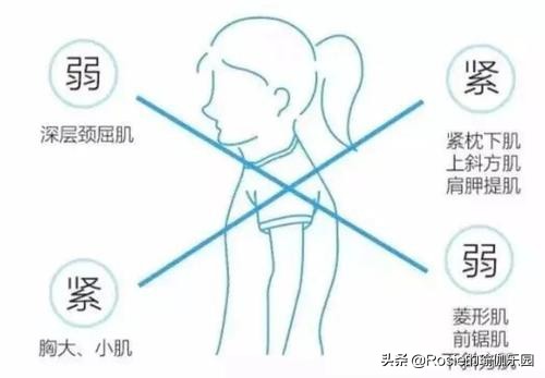 脖子前倾轻微驼背穿搭,脖子前倾体态不好怎么改善