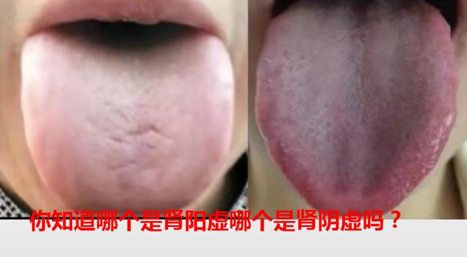 肾阳虚如何选择地黄丸,肝肾阴虚吃哪个地黄丸比较好