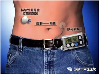 医院举办世界糖尿病日义诊活动,医院糖尿病日宣传义诊活动