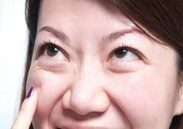 食物过敏眼睛肿多久才消退,眼睛肿了吃什么最好