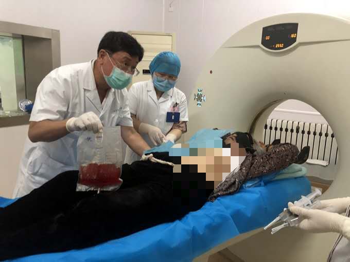 为90岁高龄的老大娘进行缓释库治疗