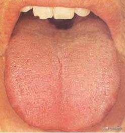 最实用的舌诊图六大舌象,舌诊深入学习书