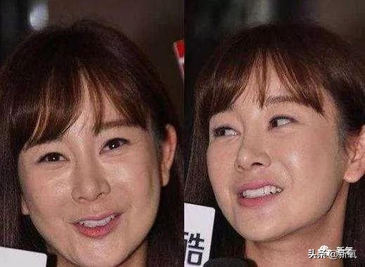 张檬把自己整成网红脸,张檬整哪里了