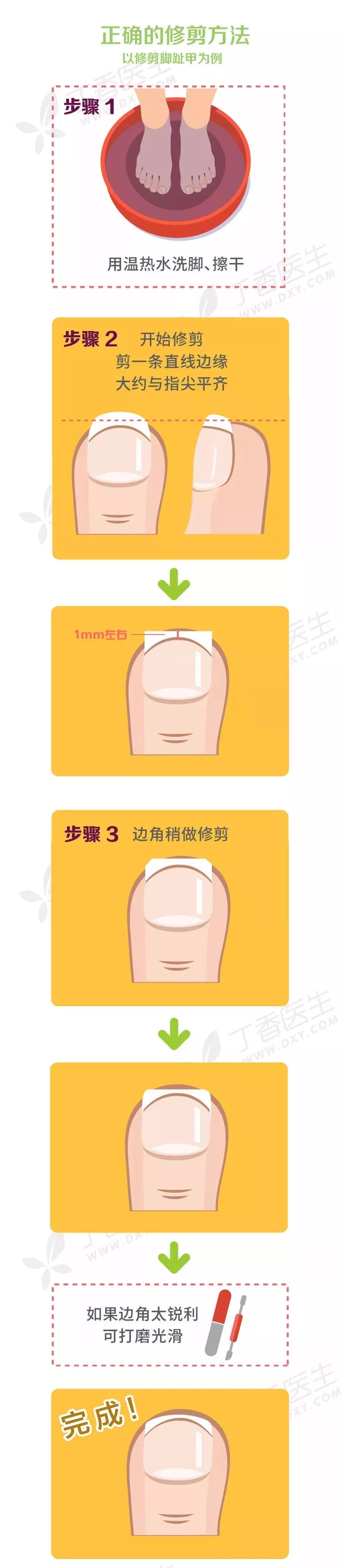 脚趾根部肿痛化脓怎么回事,脚趾发炎化脓了在家怎么处理