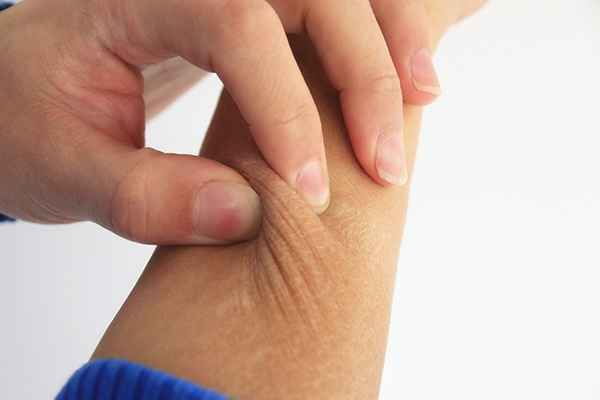 皮肤有小白点是白癜风,白癜风皮肤变化的几个阶段表现