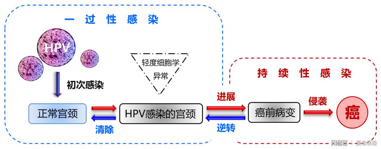 关于高危型hpv感染的视频,hpv恐慌