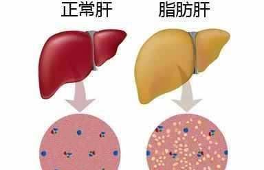 酒基因突变,酒基因