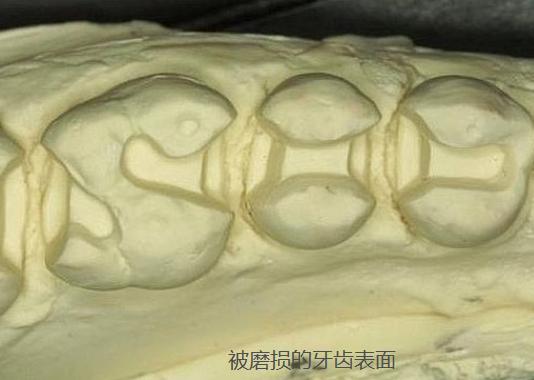 牙黄口臭怎么办用什么牙膏,黄牙口臭解决方法牙膏