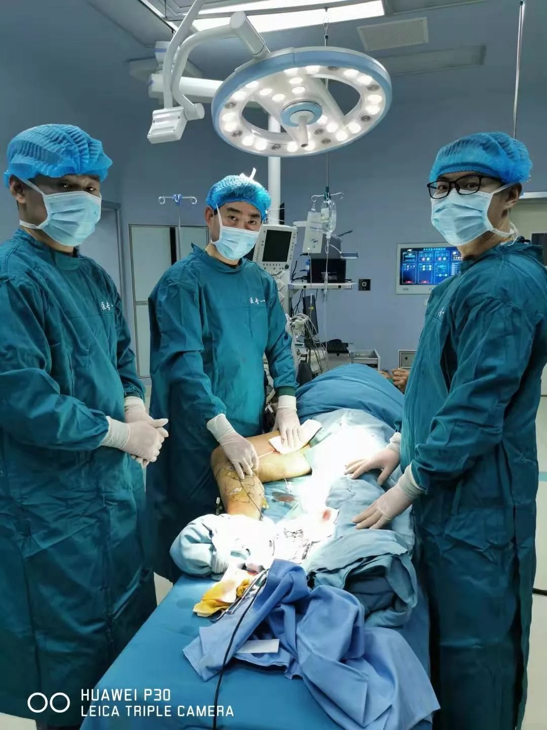 血管外科静脉曲张科普,静脉曲张病历案例