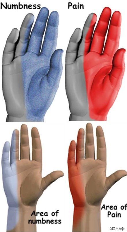 人体神经系统完整解剖图,超全神经系统解剖图近乎完美