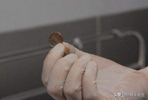 为什么会把异物塞进尿道,为什么会有人往尿道里塞异物