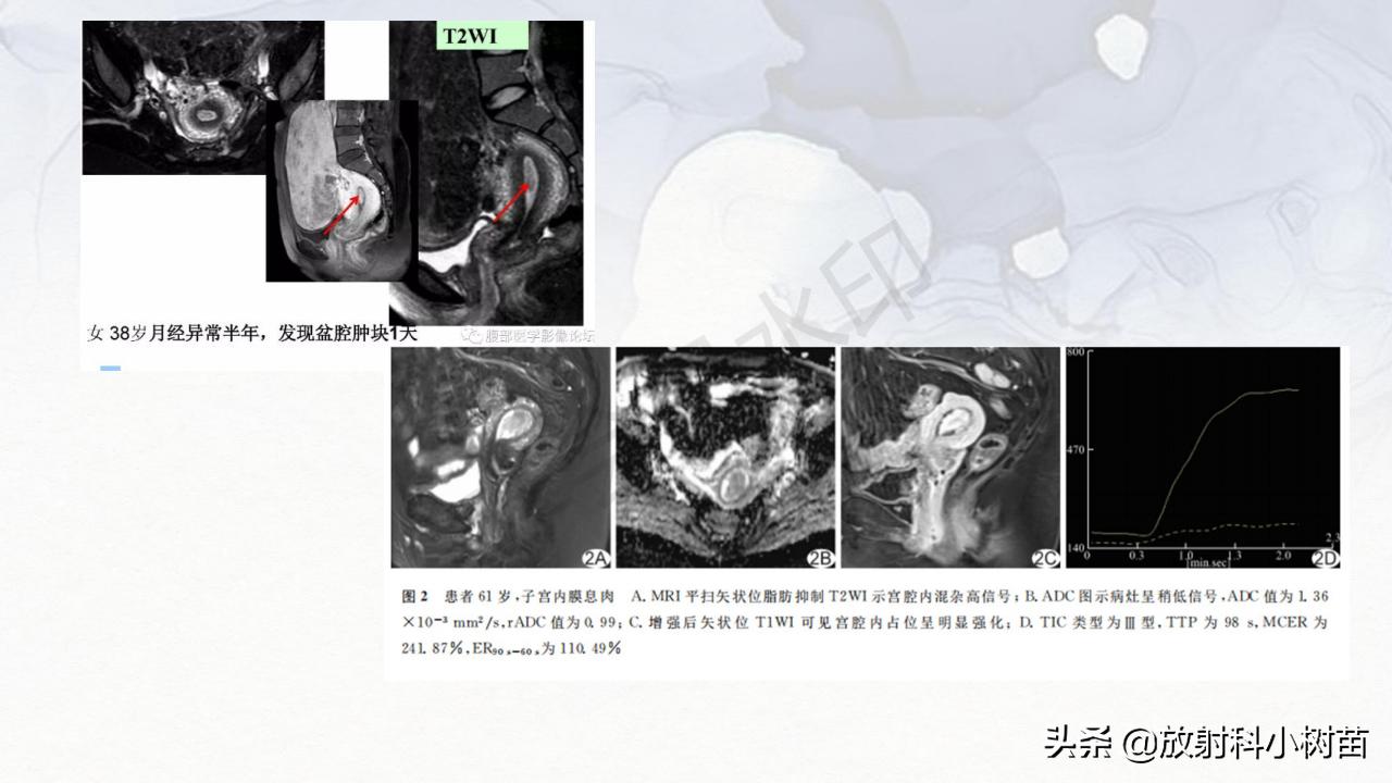 女性盆腔mri解剖图谱,泌尿生殖系统x线解剖