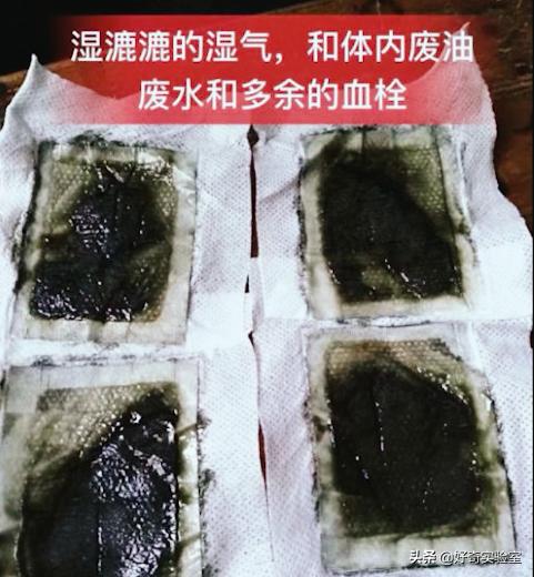 老北京足贴变黑真的排湿气减肥吗,足贴排毒真的有效吗